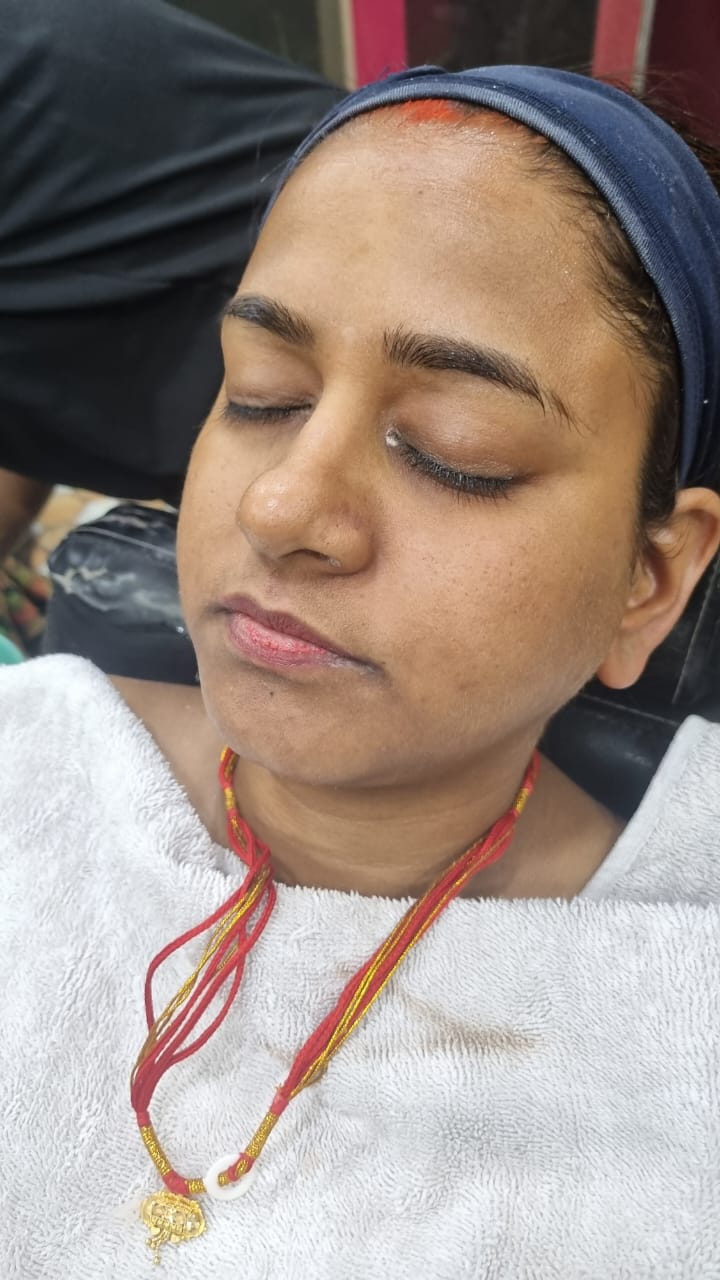 Skin photo from Looks and Locks Jamshedpur archive